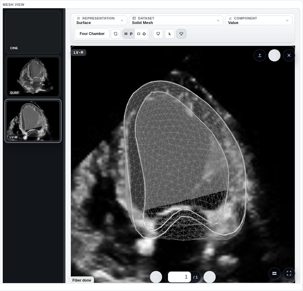 Mesh View resting on the third snapshot of a DICOM album: the finished trimmed left-ventricle mesh fills the viewport, and the album stepper below it reads 3 of 3.
